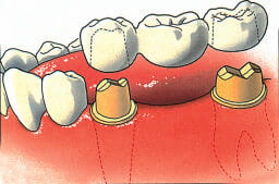 Tandheelkundige brug