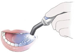 verharden van de lak